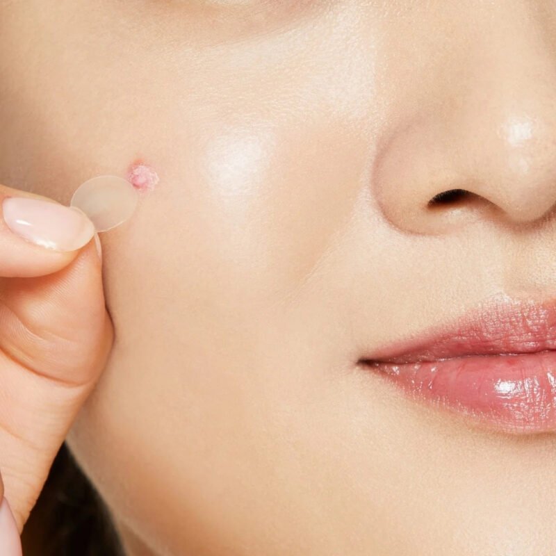 COSRX - Acne Pimple Master Patch [24 parches] - Imagen 4
