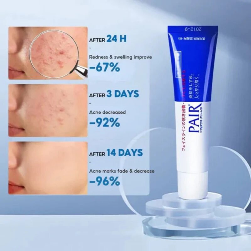 LION - Pair Acne Cream W [24g] - Imagen 4